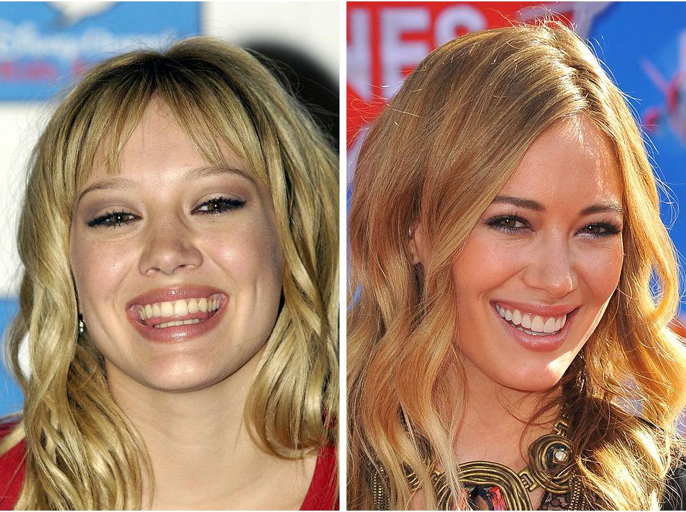 33 примера того как хорошие зубы изменили лицо!